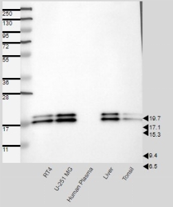 Click to enlarge image Results provided by the Human Protein Atlas (www.proteinatlas.org). Single band corresponding to the predicted size in kDa (+/-20%). Analysis performed using a standard panel of samples. Antibody dilution: 1:250.