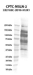 Click to enlarge image Western blot using CPTC-MSLN-2 as primary antibody against of mesothelin (MSLN), transcript variant 1 transient overexpression lysate. The expected molecular weight is 67.9 kDa.