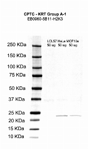 点击放大图像，使用CPTC-KRT组A-1作为针对细胞裂解物LCL57（第2通道）、HeLa（第3通道）和MCF10A（第4通道）的主要抗体的Western Blot。还包括分子量标准（车道1）