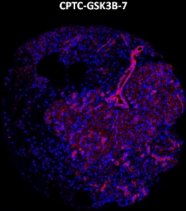 Click to enlarge image Imaging mass cytometry on normal pancreas tissue core using CPTC-GSK3B-7 metal-labeled antibody.  Data shows an overlay of the target protein signal (red) and DNA (blue). Dilution: 1:100 of 0.5mg/mL stock. Signal was also obtained in other normal tissues (liver, placenta, prostate, pancreas, breast, and spleen) and cancer tissues (breast, colon, ovarian, lung, and prostate).