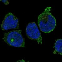 Click to enlarge image Results provided by the Human Protein Atlas (www.proteinatlas.org). The subcellular location is supported by literature. Immunofluorescent staining of human cell line THP-1 shows localization to plasma membrane & centriolar satellites. 

Human assay: THP-1 fixed with PFA, dilution: 1:100
Human assay: U2OS fixed with PFA, dilution: 1:100