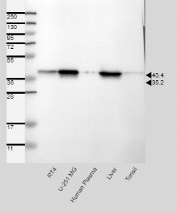 Click to enlarge image Results provided by the Human Protein Atlas (www.proteinatlas.org). Single band corresponding to the predicted size in kDa (+/-20%). Analysis performed using a standard panel of samples. Antibody dilution: 1:250