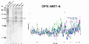 Click to enlarge image Automated western blot using CPTC-AKT1-6 as primary antibody against whole lysates of cell lines cell MDA-MB-231, HT-29, MCF7, T47D, SK-OV-3, and HeLa. The antibody cannot recognize the target in the cell lysates.