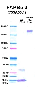 Click to enlarge image Western Blot using CPTC-FABP5-3 as primary Ab against FABP5 (Ag 10280) (lane 2). Also included are molecular wt. standards (lane 1) and mouse IgG control (lane 3).