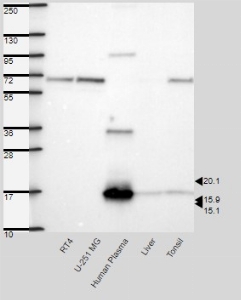 Click to enlarge image Results provided by the Human Protein Atlas (www.proteinatlas.org). Band of predicted size in kDa (+/-20%) with additional bands present. Analysis performed using a standard panel of samples. Antibody dilution: 1:500.