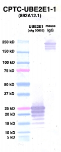 Click to enlarge image Western Blot using CPTC-UBE2E1-1 as primary Ab against UBE2E1 (rAg 00055) (lane 2). Also included are molecular wt. standards (lane 1) and mouse IgG control (lane 3).
