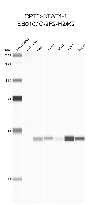 Click to enlarge image Automated western blot using CPTC-STAT1-1 as primary antibody against buffy coat (lane 2), HeLa (lane 3), Jurkat (lane 4), A549 (lane 5), MCF7 (lane 6), and H226 (lane 7) cell lysates.  Expected molecular weight - 87 kDa.  Molecular weight standards are also included (lane 1). Data is negative/inconclusive.