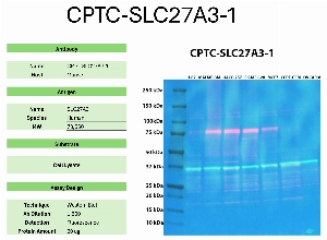 Click to enlarge image Western blot using CPTC-SLC27A3-1 as primary antibody against the whole lysates of U-87, MALME-3M, UACC-257, SK-MEL-28, MCF7, CCRF-CEM, and OVCAR-8. The antibody detected the target protein (~73.5 KDa) in MALME-3M, UACC-257, SK-MEL-28, and MCF7 cell lysates.
