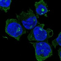 Click to enlarge image Results provided by the Human Protein Atlas (www.proteinatlas.org).

The subcellular location is partly supported by literature or no literature is available. Immunofluorescent staining of human cell line THP-1 shows localization to nucleoli & plasma membrane.

Human assay: THP-1 fixed with PFA, dilution: 1:200
Human assay: U2OS fixed with PFA, dilution: 1:200