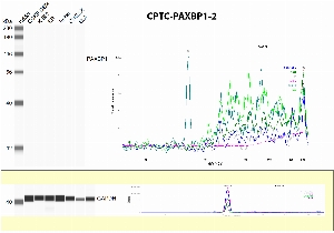Click to enlarge image Western Blot using CPTC-PAXBP1-1 as primary antibody against human cell lysates CCRF-CEM, K-52, MOLT-, SR, Jurkat and mouse cell lysates CHI2.LX and EL4 (expected MW is about 105 KDa). The antibody CPTC-PAXBP1-1 does not recognize the endogenous protein in any of the tested lysates. Cell lines were also tested for GAPDH.
