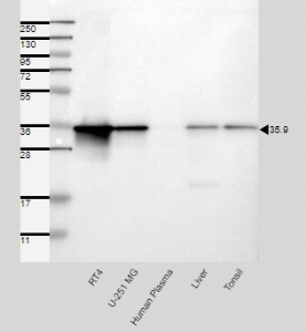 Click to enlarge image Results provided by the Human Protein Atlas (www.proteinatlas.org). Band of predicted size in kDa (+/-20%) with additional bands present. Analysis performed using a standard panel of samples. Antibody dilution: 1:500