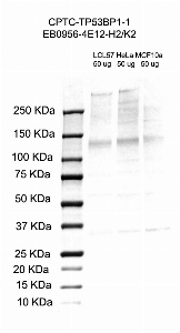 Click to enlarge image Western Blot using CPTC-TP53BP1-1 as primary antibody against cell lysates LCL57 (lane 2), HeLa (lane 3) and MCF10A (lane 4). Also included are molecular weight standards (lane 1).