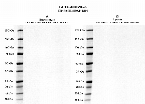 Click to enlarge image Western blot using CPTC-MUC16-3 as primary antibody against cell culture supernatants OVCAR-3 (lane 2), OVCAR-4 (lane 3), OVCAR-8 (lane 4), and SK-OV-3 (lane 5) (Panel A) and against cell lysates OVCAR-3 (lane 2), OVCAR-4 (lane 3), OVCAR-8 (lane 4), and SK-OV-3 (lane 5) (Panel B). Molecular weight standards are also included in each panel (lane 1). Expected molecular weight > 250 kDa.