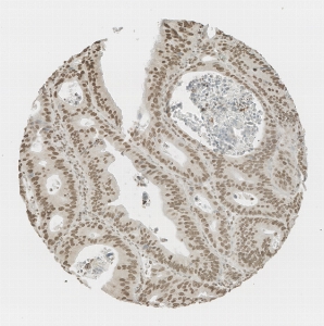 Click to enlarge image Tissue Micro-Array (TMA) core of colon  showing nuclear staining using Antibody CPTC-ARG1-1. Titer: 1:200