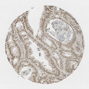 点击放大图像，结肠组织微阵列（TMA）核心显示使用抗体CPTC-ARG1-1进行核染色。标题：1:200