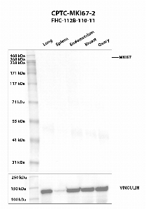 Click to enlarge image Western blot using CPTC-MKI67-2 as primary antibody against human lung (2), spleen (3), endometrium (4), breast (5), and ovary (6) tissue lysates. The expected molecular weight is 358.7 kDa and 319.4 kDa. Vinculin was used as a loading control.