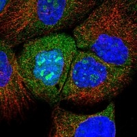 Click to enlarge image Results provided by the Human Protein Atlas (www.proteinatlas.org).  The subcellular location is partly supported by literature or no literature is available. Immunofluorescent staining of human cell line A-431 shows localization to nucleoplasm, nucleoli & cytosol. 
Human assay: A-431 fixed with PFA, dilution: 1:20
Human assay: U-2 OS fixed with PFA, dilution: 1:20
Human assay: U-251 MG fixed with PFA, dilution: 1:20