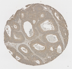 Click to enlarge image Tissue Micro-Array (TMA) core of colon  showing cytoplasmic staining using Antibody CPTC-CXCL10-2. Titer: 1:1000
The pattern of staining is correct but lacks sufficient literature data to confirm cell type specificity.