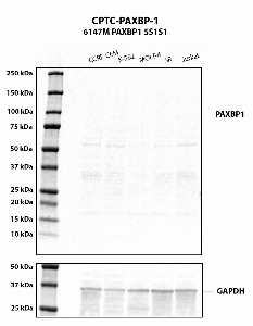 Click to enlarge image Western blot using CPTC-PAXBP1-1 as primary antibody against human cell lysates CCRF-CEM, K-52, MOLT-, SR and Jurkat whole cell lysates.  Expected MW is about 105 kDa. The antibody CPTC-PAXBP1-1 does not recognize the endogenous protein in any of the tested lysates.