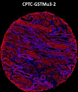 Click to enlarge image Imaging mass cytometry on normal kidney tissue core using CPTC-GSTMu3-2 metal-labeled antibody.  Data shows overlay of target protein signal (red) and DNA (blue). Dilution: 1:100 of 0.5mg/mL stock. Signal was also obtained in other normal tissues (testis, liver, colon, endometrium, appendix, bone marrow, breast, kidney, lung, and placenta) and cancer tissues (breast, colon, prostate, lung, and ovarian).