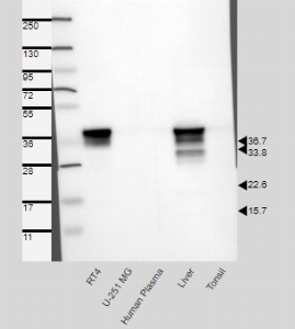 Click to enlarge image Results provided by the Human Protein Atlas (www.proteinatlas.org). Band of predicted size in kDa (+/-20%) with additional bands present. Analysis performed using a standard panel of samples. Antibody dilution: 1:500.