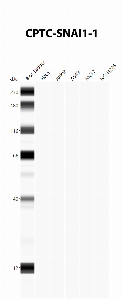 Click to enlarge image Automated Western Blot using CPTC-SNAI1-1 as primary antibody against cell lysates A549, H226, HeLa, Jurkat and MCF7. Expected MW of 29.1 KDa. All cell lysates negative.  Molecular weight standards are also included (lane 1).