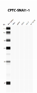 点击放大图像使用CPTC-SNAI1-1作为针对细胞裂解物A549、H226、HeLa、Jurkat和MCF7的第一抗体的自动蛋白质印迹。预计MW为29.1 KDa。所有细胞裂解呈阴性。还包括分子量标准（车道1）。