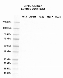Click to enlarge image Western blot using CPTC-CD8A-1 as primary antibody against HeLa (lane 2), Jurkat (lane 3), A549 (lane 4), MCF7 (lane 5), and H226 (lane 6) whole cell lysates.  Expected molecular weight - 25.7 kDa, 21.6 kDa, and 30.2 kDa.  Molecular weight standards are also included (lane 1).