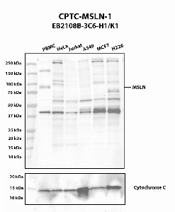 Click to enlarge image Western blot using CPTC-MSLN-1 as primary antibody against human PBMC (2), HeLa (3), Jurkat (4), A549 (5), MCF7 (6) and H226 (7) whole cell lysates. The expected molecular weight is 69.0 kDa. Cytochrome C was used as a loading control. PBMC is presumed positive. All other cell lines are negative.