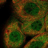 Click to enlarge image Results provided by the Human Protein Atlas (www.proteinatlas.org). The subcellular location is supported by literature. Immunofluorescent staining of human cell line A-431 shows localization to nucleoplasm & cytosol. Human assay: A-431 fixed with PFA, dilution: 1:50
Human assay: U-2 OS fixed with PFA, dilution: 1:50
Human assay: U-251 MG fixed with PFA, dilution: 1:50