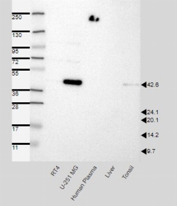 Click to enlarge image Results provided by the Human Protein Atlas (www.proteinatlas.org). Band of predicted size in kDa (+/-20%) with additional bands present. Analysis performed using a standard panel of samples. Antibody dilution: 1:500.