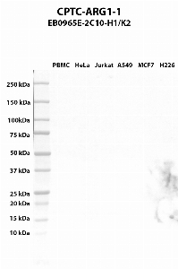 Click to enlarge image Western blot using CPTC-ARG1-1 as primary antibody against PBMC (lane 2), HeLa (lane 3), Jurkat (lane 4), A549 (lane 5), MCF7 (lane 5), and NCI-H226 (lane 6) whole cell lysates.  Expected molecular weight - 34.7 kDa, 35.7 kDa, and 25.4 kDa.  Molecular weight standards are also included (lane 1).