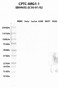 点击放大图像Western blot，使用CPTC-ARG1-1作为针对PBMC（第2道）、HeLa（第3道）、Jurkat（第4道）、A549（第5道）、MCF7（第5车道）和NCI-H226（第6道）全细胞裂解物的主要抗体。预期分子量-34.7 kDa、35.7 kDa和25.4 kDa。还包括分子量标准（车道1）。