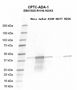 Click to enlarge image Western blot using CPTC-ADA-1 as primary antibody against HeLa (lane 2), Jurkat (lane 3), A549 (lane 4), MCF7 (lane 5), and H226 (lane 6) whole cell lysates.  Expected molecular weight - 40.8 kDa.  Molecular weight standards are also included (lane 1).