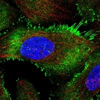 Click to enlarge image Results provided by the Human Protein Atlas (www.proteinatlas.org). The subcellular location is supported by literature. Immunofluorescent staining of human cell line U-2 OS shows localization to plasma membrane. uman assay: A-431 fixed with PFA, dilution: 1:2000
Human assay: U-2 OS fixed with PFA, dilution: 1:2000
Human assay: U-251 MG fixed with PFA, dilution: 1:2000