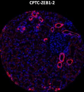 Click to enlarge image Imaging mass cytometry on normal kidney tissue core using CPTC-ZEB1-2 metal-labeled antibody.  Data shows an overlay of the target protein signal (red) and DNA (blue). Dilution: 1:100 of 0.5mg/mL stock. Signal was also obtained in other normal tissues (colon, pancreas, breast, testis, endometrium, appendix, and kidney) and cancer tissues (breast, colon, ovarian, and lung).