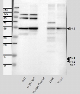 Click to enlarge image Results provided by the Human Protein Atlas (www.proteinatlas.org). Band of predicted size in kDa (+/-20%) with additional bands present. Analysis performed using a standard panel of samples. Antibody dilution: 1:500