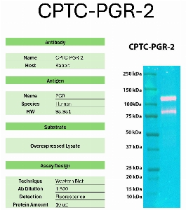 Click to enlarge image Western Blot of CPTC-PGR-2 against the over-expressed lysate of PGR. Expected MW is 98.9 KDa. The antibody detected the target protein.