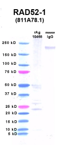 Click to enlarge image Western Blot using CPTC-RAD52-1 as primary Ab against PNMT (rAg 10468) in lane 2. Also included are molecular wt. standards (lane 1) and mouse IgG control (lane 3).