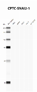 Click to enlarge image Automated Western Blot using CPTC-SNAI2-1 as primary antibody against cell lysates A549, H226, HeLa, Jurkat and MCF7. Expected MW of 30.0 KDa. All cell lysates negative.  Molecular weight standards are also included (lane 1).