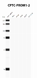 Click to enlarge image Automated Western Blot using CPTC-PROM1-2 as primary antibody against cell lysates A549, H226, HeLa, Jurkat and MCF7. Expected MW of 97 KDa. All cell lysates negative.  Molecular weight standards are also included (lane 1).