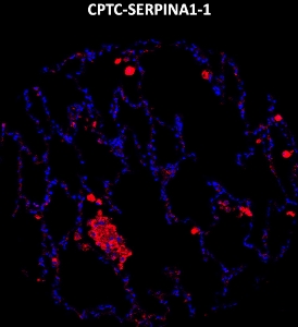 Click to enlarge image Imaging mass cytometry on normal lung tissue core using CPTC-SERPINA1-1 metal-labeled antibody.  Data shows an overlay of the target protein signal (red) and DNA (blue). Dilution: 1:100 of 0.5mg/mL stock. Signal was also obtained in other normal tissues (liver, bone marrow, spleen, placenta, prostate, colon, pancreas, breast, lung, testis, endometrium, appendix, and kidney) and cancer tissues (breast, colon, ovarian, lung, and prostate).
