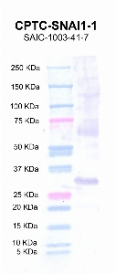 Click to enlarge image Western blot using CPTC-SNAI1-1 as primary antibody against full length SNAIL protein (lane 2) with expected MW of 31.8 KDa.  Molecular weight standards are also included (lane 1).
