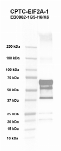 Click to enlarge image Western blot using CPTC-EIF2A-1 as primary antibody against recombinant protein of human eukaryotic translation initiation factor 2A, (EIF2A) (lane 2). Molecular weight standards are also included (lane 1). Expected molecular weight – 64.8 kDa. Blot was developed using chemiluminescence (ECL).