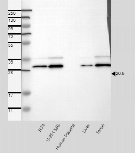 Click to enlarge image Results provided by the Human Protein Atlas (www.proteinatlas.org). Band of predicted size in kDa (+/-20%) with additional bands present. Analysis performed using a standard panel of samples. Antibody dilution: 1:250.