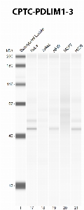 Click to enlarge image Automated Western Blot using CPTC-PDLIM1-3 as primary Ab against cell lysate from HeLa, Jurkat, A549, MCF7 and H226 cells (lane 2-6). Also included are molecular wt. standards (lane 1). Expected MW is 36 KDa. ECL detection. Positive for HeLa, A549 and H226.
