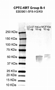 Click to enlarge image Western blot using CPTC-KRT Group B-1 as primary antibody against LCL57, HeLa, and MCF10A cell lysates.  Molecular weight standards are also included.