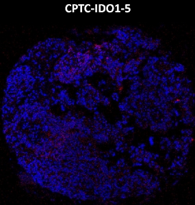 Click to enlarge image Imaging mass cytometry on ovarian cancer tissue core using CPTC-IDO1-5 metal-labeled antibody.  Data shows overlay of target protein signal (red) and DNA (blue). Dilution: 1:100 of 0.5mg/mL stock. Signal was also obtained in other normal tissue (appendix) and cancer tissue (ovarian).