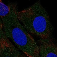 Click to enlarge image Results provided by the Human Protein Atlas (www.proteinatlas.org). The subcellular location is supported by literature. Immunofluorescent staining of human cell line U2OS shows localization to cytosol. Human assay: THP-1 fixed with PFA, dilution: 1:100
Human assay: U2OS fixed with PFA, dilution: 1:100