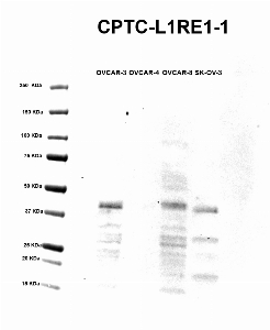 Click to enlarge image Western blot using CPTC-L1RE1-1 as primary antibody against  cell lysates OVCAR-3 (lane 2), OVCAR-4 (lane 3), OVCAR-8 (lane 4), and SK-OV-3 (lane 5). Molecular weight standards are also included (lane 1). Expected molecular weight 40KDa.